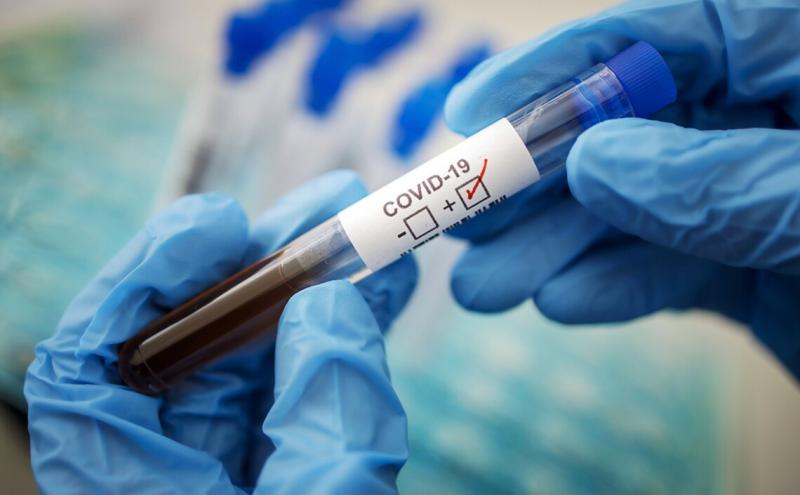 У Харківській області спостерігається зростання випадків COVID-19: яка кількість пацієнтів в медичних закладах?