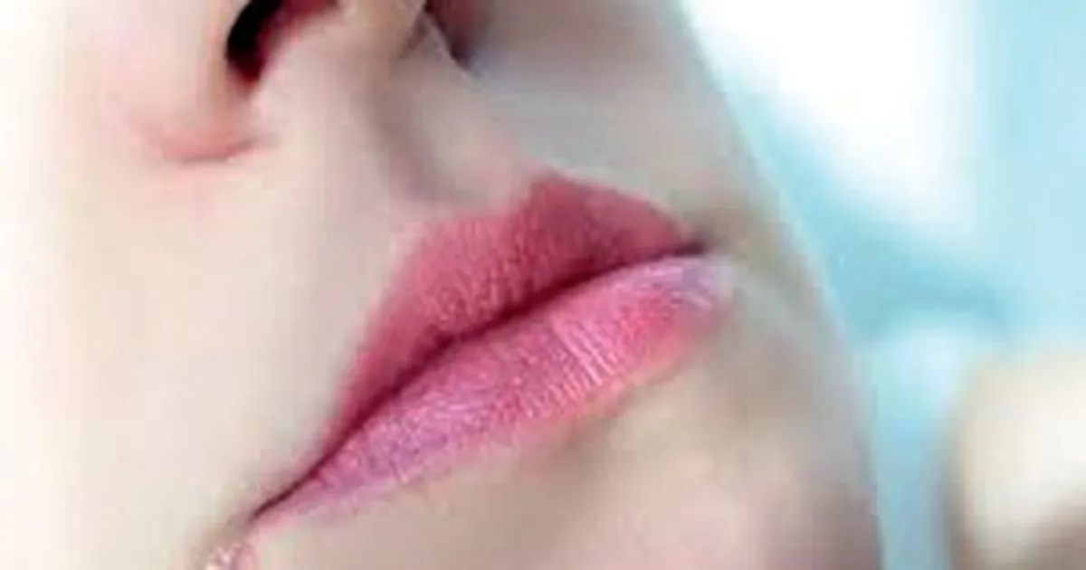 Чому виникають заїди і як з ними боротися?