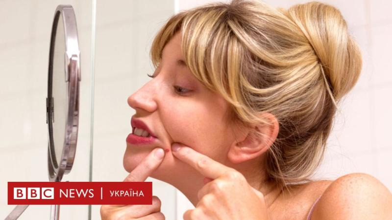 Вичавлювання вугрів: чому нас приваблює щось непривабливе - BBC News Україна