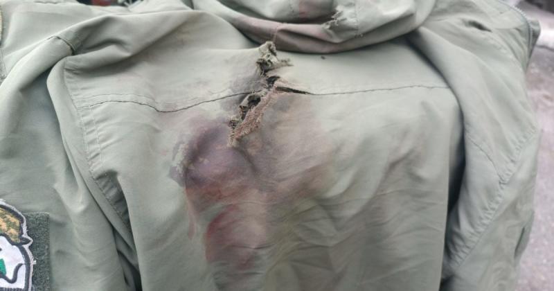 В Україні зафіксовано захворювання, яке не спостерігалося з часів Першої світової війни, повідомляє The Telegraph.